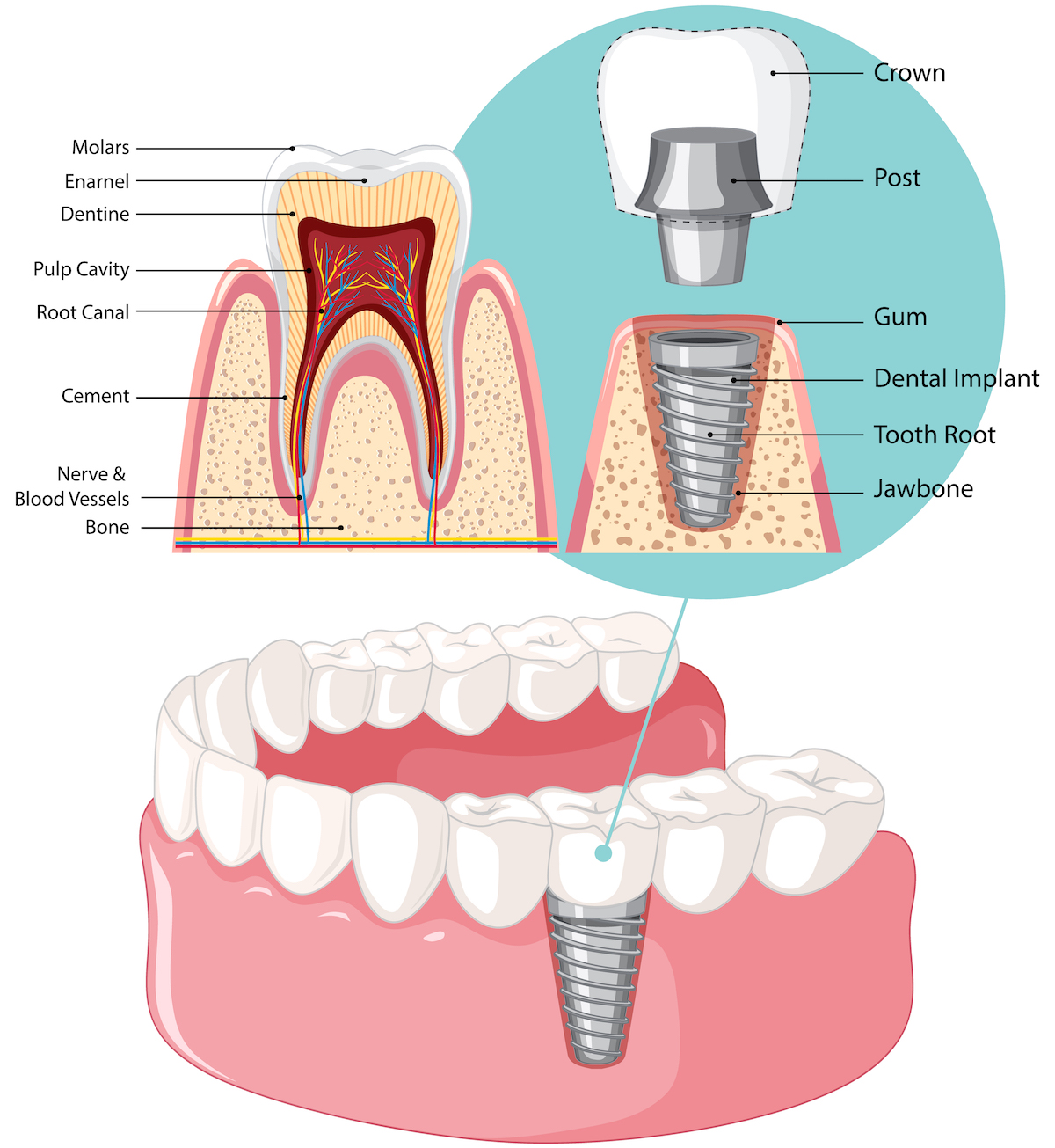 Sunday Dentist in Riverdale, Bronx Schoengold Dentistry.